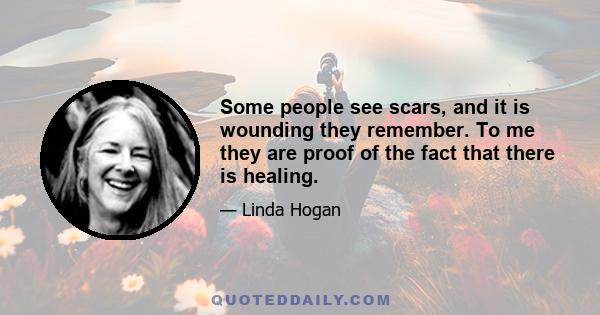 Some people see scars, and it is wounding they remember. To me they are proof of the fact that there is healing.