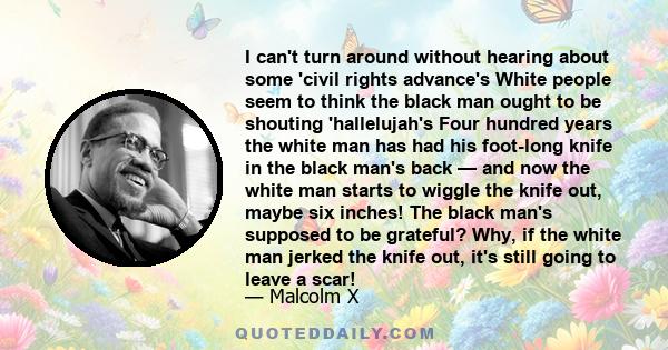 I can't turn around without hearing about some 'civil rights advance's White people seem to think the black man ought to be shouting 'hallelujah's Four hundred years the white man has had his foot-long knife in the