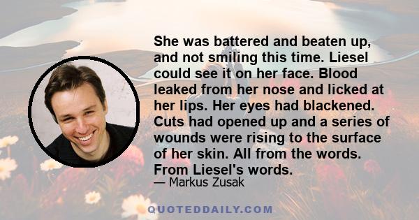 She was battered and beaten up, and not smiling this time. Liesel could see it on her face. Blood leaked from her nose and licked at her lips. Her eyes had blackened. Cuts had opened up and a series of wounds were