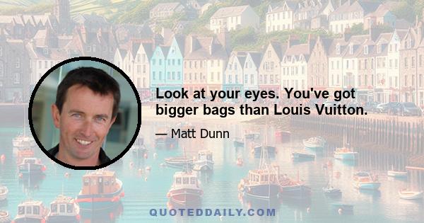 Look at your eyes. You've got bigger bags than Louis Vuitton.