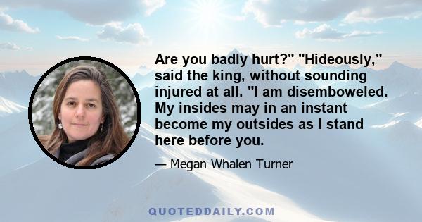 Are you badly hurt? Hideously, said the king, without sounding injured at all. I am disemboweled. My insides may in an instant become my outsides as I stand here before you.