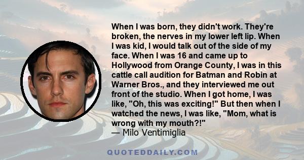 When I was born, they didn't work. They're broken, the nerves in my lower left lip. When I was kid, I would talk out of the side of my face. When I was 16 and came up to Hollywood from Orange County, I was in this