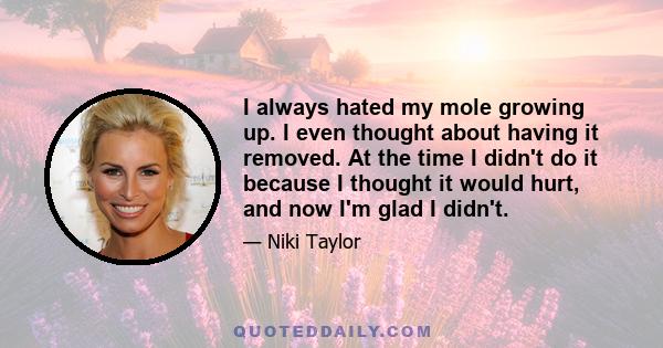 I always hated my mole growing up. I even thought about having it removed. At the time I didn't do it because I thought it would hurt, and now I'm glad I didn't.