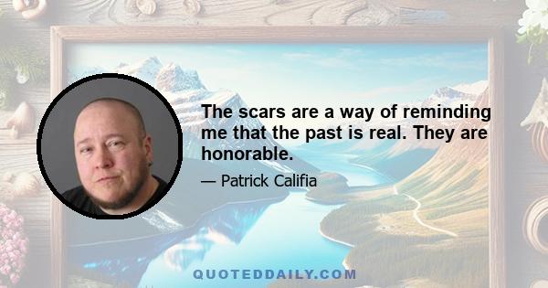 The scars are a way of reminding me that the past is real. They are honorable.