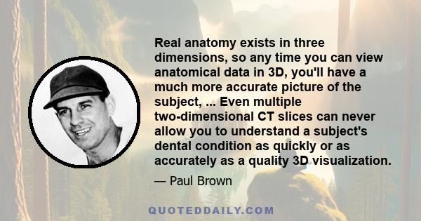 Real anatomy exists in three dimensions, so any time you can view anatomical data in 3D, you'll have a much more accurate picture of the subject, ... Even multiple two-dimensional CT slices can never allow you to