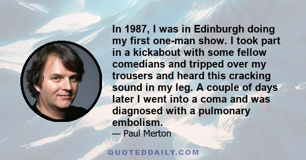 In 1987, I was in Edinburgh doing my first one-man show. I took part in a kickabout with some fellow comedians and tripped over my trousers and heard this cracking sound in my leg. A couple of days later I went into a