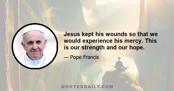 Jesus kept his wounds so that we would experience his mercy. This is our strength and our hope.