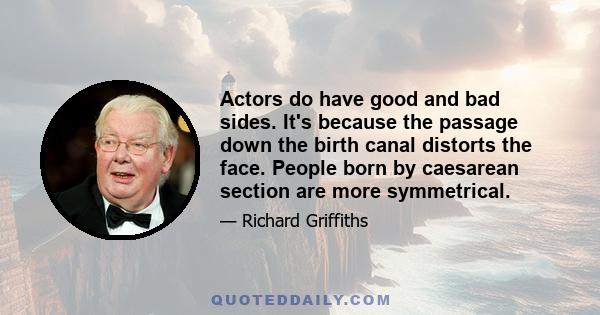 Actors do have good and bad sides. It's because the passage down the birth canal distorts the face. People born by caesarean section are more symmetrical.