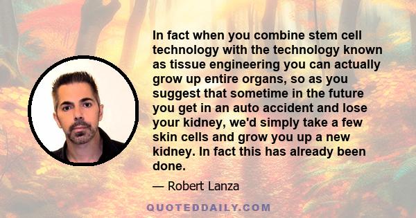 In fact when you combine stem cell technology with the technology known as tissue engineering you can actually grow up entire organs, so as you suggest that sometime in the future you get in an auto accident and lose