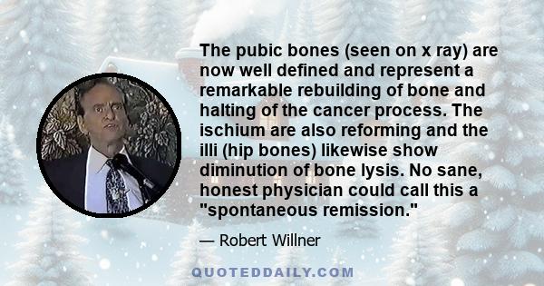 The pubic bones (seen on x ray) are now well defined and represent a remarkable rebuilding of bone and halting of the cancer process. The ischium are also reforming and the illi (hip bones) likewise show diminution of