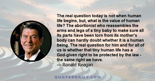 The real question today is not when human life begins, but, what is the value of human life? The abortionist who reassembles the arms and legs of a tiny baby to make sure all its parts have been torn from its mother's