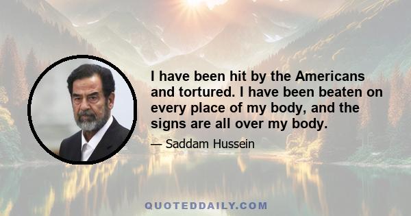 I have been hit by the Americans and tortured. I have been beaten on every place of my body, and the signs are all over my body.