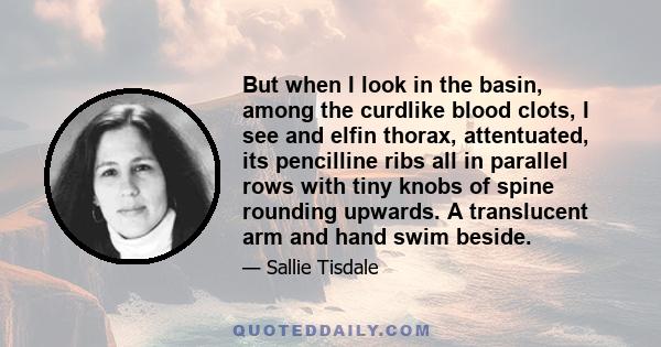 But when I look in the basin, among the curdlike blood clots, I see and elfin thorax, attentuated, its pencilline ribs all in parallel rows with tiny knobs of spine rounding upwards. A translucent arm and hand swim