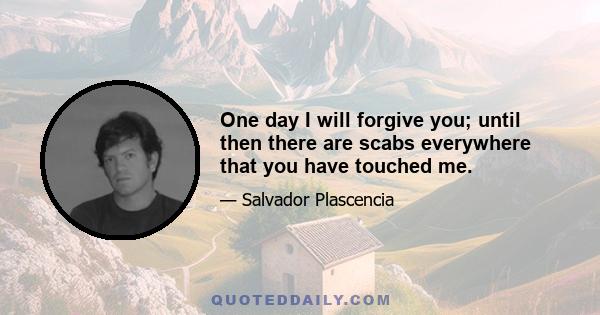 One day I will forgive you; until then there are scabs everywhere that you have touched me.