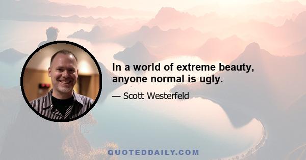 In a world of extreme beauty, anyone normal is ugly.