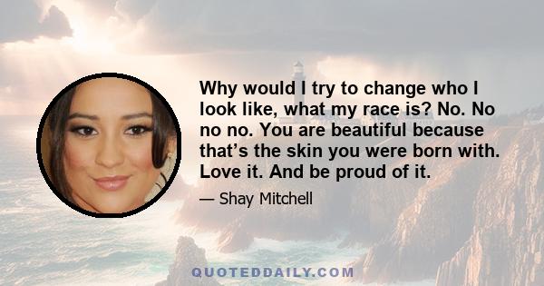 Why would I try to change who I look like, what my race is? No. No no no. You are beautiful because that’s the skin you were born with. Love it. And be proud of it.