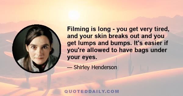 Filming is long - you get very tired, and your skin breaks out and you get lumps and bumps. It's easier if you're allowed to have bags under your eyes.