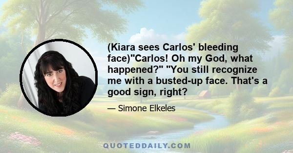 (Kiara sees Carlos' bleeding face)Carlos! Oh my God, what happened? You still recognize me with a busted-up face. That's a good sign, right?