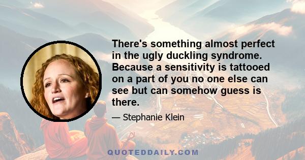 There's something almost perfect in the ugly duckling syndrome. Because a sensitivity is tattooed on a part of you no one else can see but can somehow guess is there.