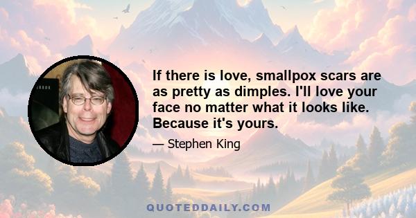 If there is love, smallpox scars are as pretty as dimples. I'll love your face no matter what it looks like. Because it's yours.