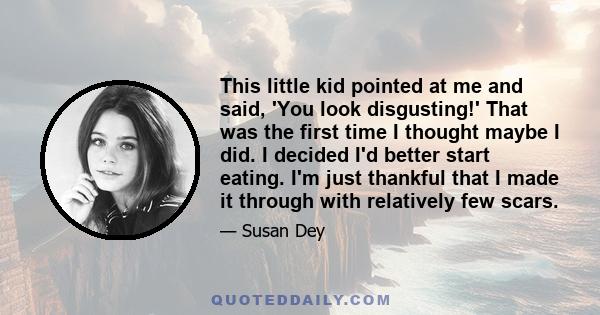 This little kid pointed at me and said, 'You look disgusting!' That was the first time I thought maybe I did. I decided I'd better start eating. I'm just thankful that I made it through with relatively few scars.