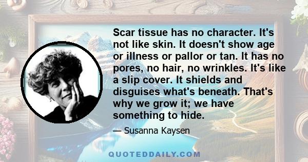 Scar tissue has no character. It's not like skin. It doesn't show age or illness or pallor or tan. It has no pores, no hair, no wrinkles. It's like a slip cover. It shields and disguises what's beneath. That's why we