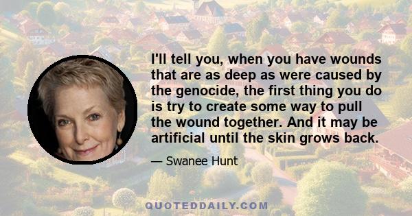 I'll tell you, when you have wounds that are as deep as were caused by the genocide, the first thing you do is try to create some way to pull the wound together. And it may be artificial until the skin grows back.