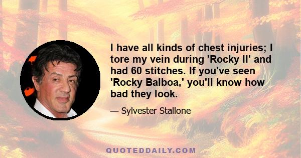 I have all kinds of chest injuries; I tore my vein during 'Rocky II' and had 60 stitches. If you've seen 'Rocky Balboa,' you'll know how bad they look.