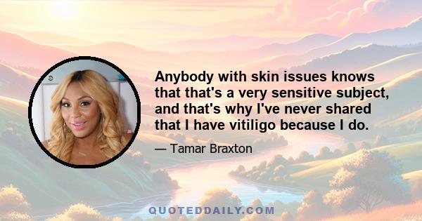 Anybody with skin issues knows that that's a very sensitive subject, and that's why I've never shared that I have vitiligo because I do.