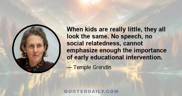 When kids are really little, they all look the same. No speech, no social relatedness, cannot emphasize enough the importance of early educational intervention.