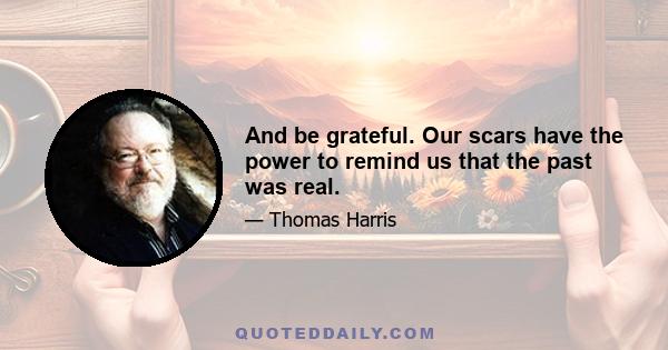 And be grateful. Our scars have the power to remind us that the past was real.