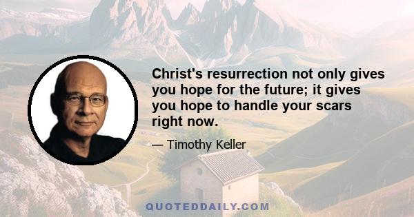 Christ's resurrection not only gives you hope for the future; it gives you hope to handle your scars right now.