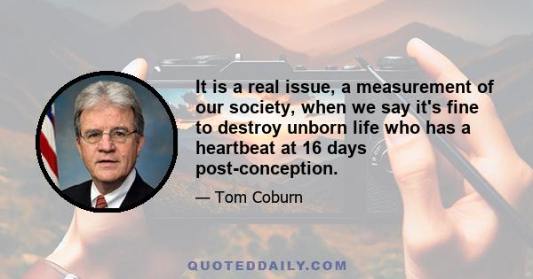 It is a real issue, a measurement of our society, when we say it's fine to destroy unborn life who has a heartbeat at 16 days post-conception.