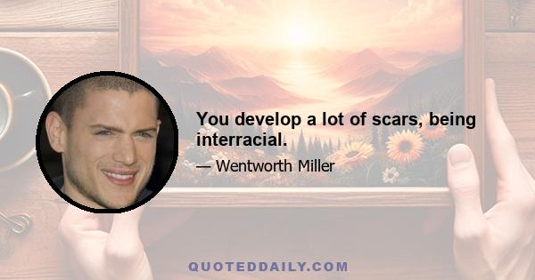 You develop a lot of scars, being interracial.